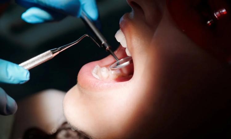 Laser marking and the dental industry